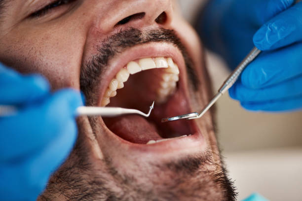 Best Emergency Tooth Extraction  in Cadiz, KY